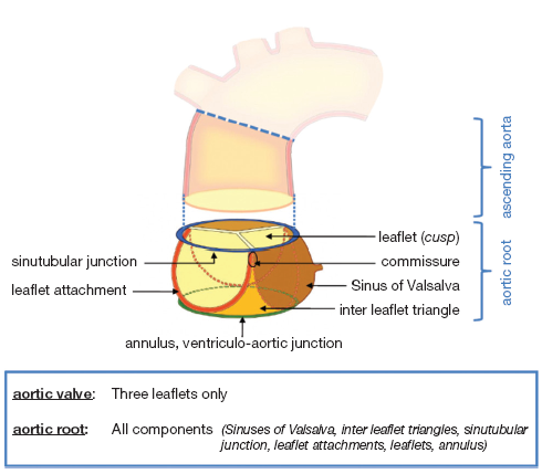 Aortic Valve Anatomy